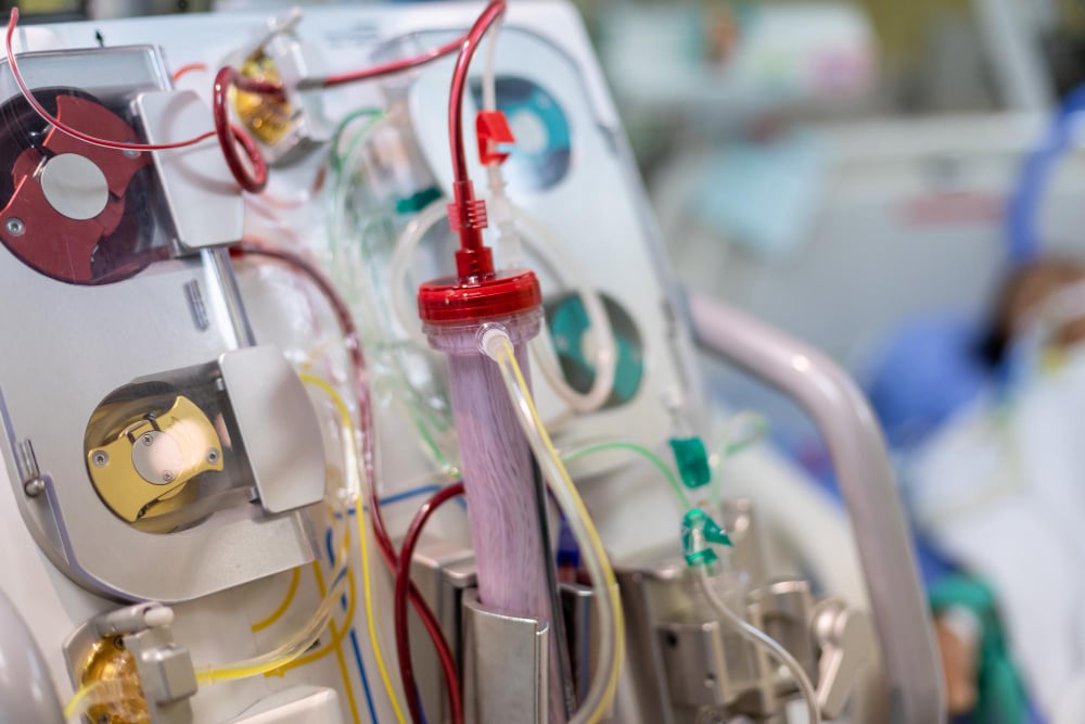 Image d’une machine de dialyse médicale montrant les circuits sanguins et le filtre, illustrant la gestion, le suivi et la maintenance des équipements de dialyse utilisés par Physidia dans le cadre des interventions à domicile et du pilotage des ordres de travail via la GMAO Omogen.